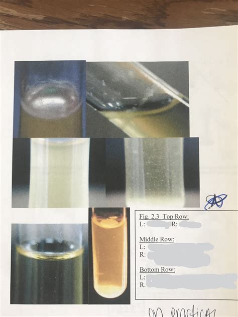 Lab Practical 1 Patterns of Growth in Broth Culture Diagram | Quizlet