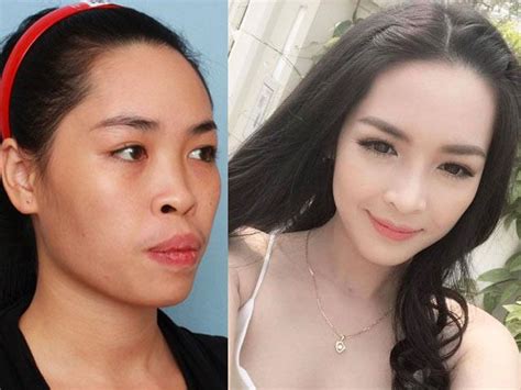 Hot girl thẩm mỹ Vũ Thanh Quỳnh thay đổi khó tin sau 5 năm thẩm mỹ 2sao