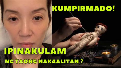 Kris Aquino Kinulam Daw O Kinarma May Nagpakulam Kay Kris Na Isa Sa