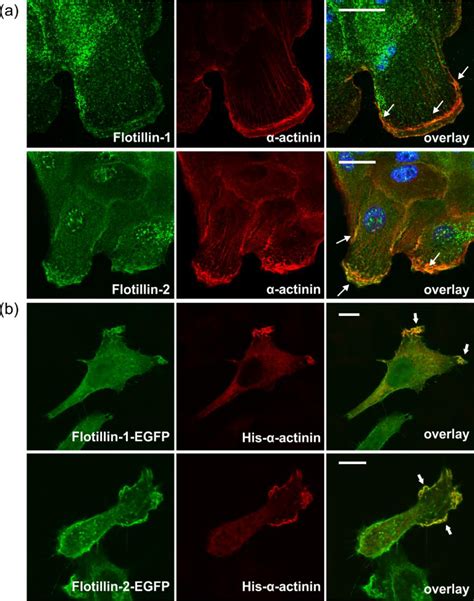 Flotillin And Flotillin Colocalize With Actinin In Peripheral