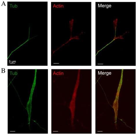 A Confocal images of double immunostaining with anti βIII tubulin