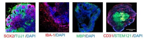 Brain Organoid Differentiation Service From IPSC Creative Bioarray