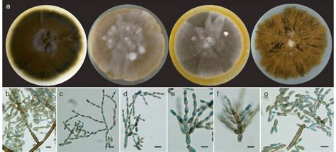 Cladosporium Pernambucoense Urm 8390 Ex Type A Colonies On Pda Mea