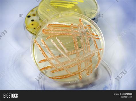 Mixed Culture Bacteria Image & Photo (Free Trial) | Bigstock