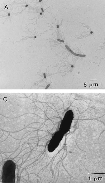 nesănătos concentra asistenţă salmonella enteritidis microscope admite pierderi India