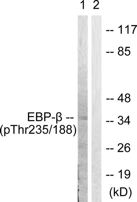 Anti Cebp Beta Cebpb Antibody Rabbit Anti Human Polyclonal Lsbio