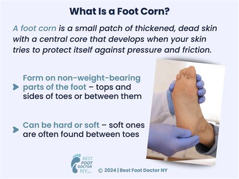 Advanced Podiatrist's Guide to Treating Common Foot Problems in or Near