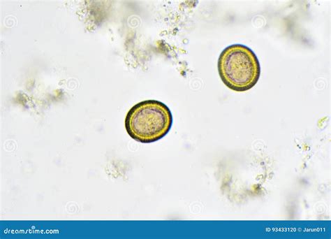 Taenia Eggs In Stool Find With Microscope Royalty Free Stock Image