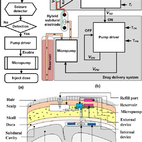 Proposed Closed Loop Drug Delivery System A Block Diagram B Flow