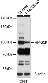 High Affinity And Specificity KO Validated HMGCR Polyclonal Antibody