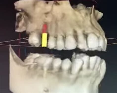 Procedimientos Multimedia Clinica Maxi Dental