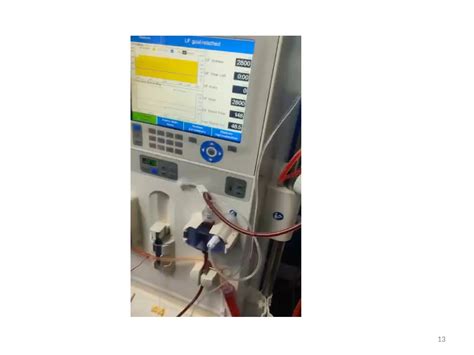 DIALYZER REUSE , Dialysis prescription.pptx