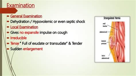 Intestinal Bowel Strangulation