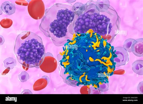 Leucemia Linfoide Cronica Immagini E Fotografie Stock Ad Alta