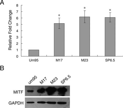 Mitf Expression Is Upregulated In Uveal Melanoma Cells A Real Time