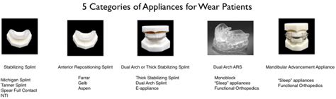 Comparing Mouth Guard Types With TMJ Splints, 53% OFF