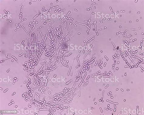 Microscopic Fungi Malassezia Furfur Showing Yeast Cells And Hyphae