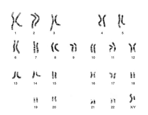 Genes y cromosomas cómo determinan nuestra vida y salud Cuestión