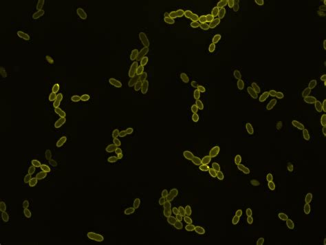 How pathogenic bacteria weather the slings and arrows of infection