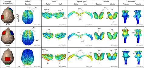 Frontiers State Of Art Neuroanatomical Target Analysis Of High