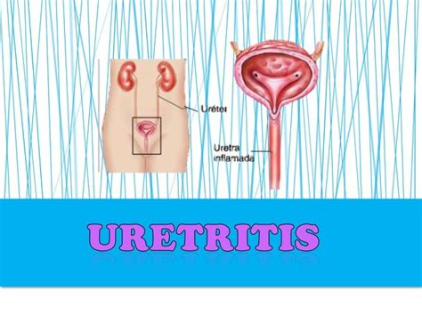 Infecci N Urinaria En El Embarazo Ppt