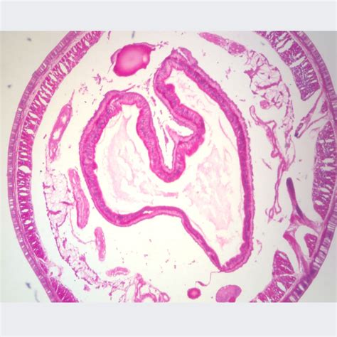 Earthworm, c.s.10 µm, H&E Microscope Slide | Carolina Biological Supply