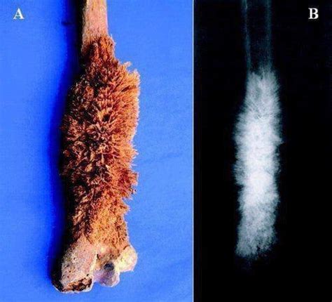 What Is The Bone Diagnosis MedTwitter Thread From Dr Ihab Suliman