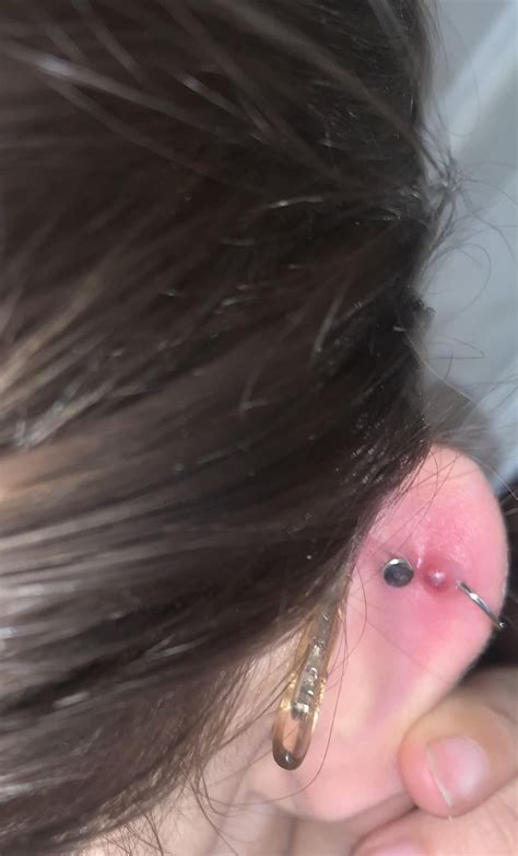 Should I Be Concerned I Had A Helix And A Flat Piercing Done On The