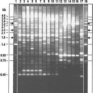 LR REP PCR Fingerprint Patterns Of Representative Bacillus Species The