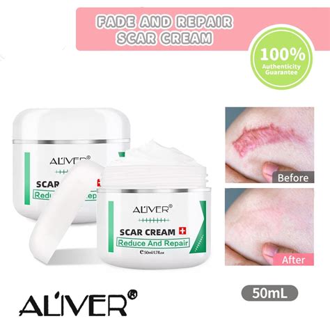 Aliver Scar Cream 50g Acne Scars Repair Stretch Marks Old Scars All