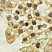 Pax3 protein expression in the human decidual cells at 7 weeks of ... 