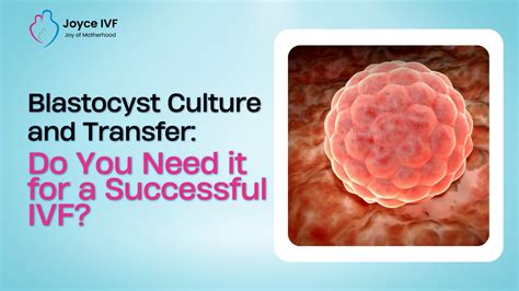 Blastocyst Culture And Transfer Do You Need It For A Successful IVF