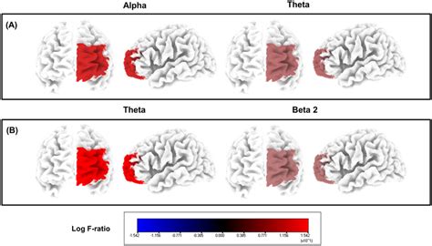 Source Localized Cortical Power Differences In The Prefrontal Cortex