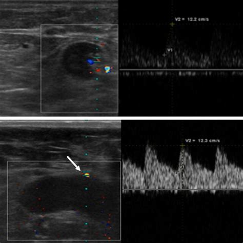 On Doppler Us A Color And B Spectral Doppler Examination Of The Download Scientific Diagram