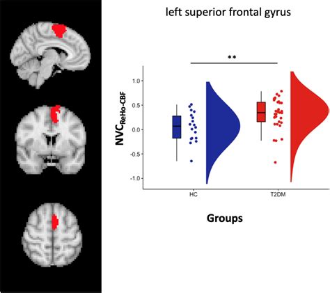 Frontiers Neurovascular Coupling In Patients With Type 2 Diabetes