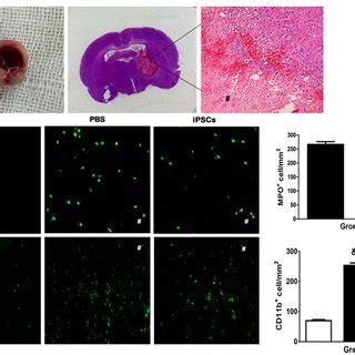 Reduction of cerebral apoptosis of neural cells in iPSC-grafted ...