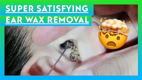 Super Satisfying Ear Wax Removal Youtube