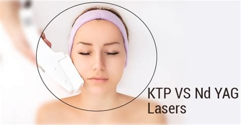 Ktp Laser Vs Nd Yag Laser Fairview Laser Clinic Inc