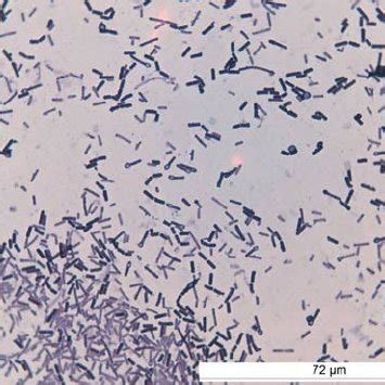 a. Spores and bacteria of Clostridium tetani with a typical drum-stick... | Download Scientific ...