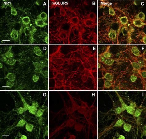 Confocal Micrograph Of The Double Immunostaining For The NR1 Subunit Of