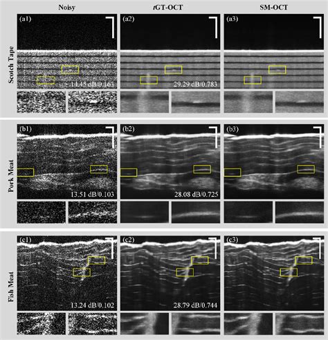 Figure 5 From Toward Ground Truth Optical Coherence Tomography Via