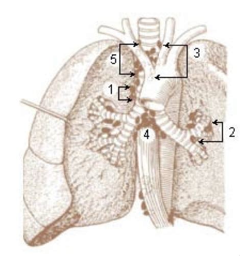 Pneumothorax Flashcards Quizlet