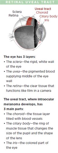 intraocular uveal melanoma patients  american society