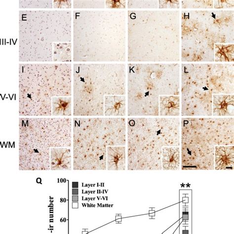 Photomicrographs Showing Iba Immunoreactive Ir Microglia A B And