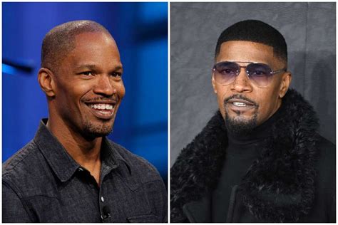 Jamie Foxx S Hair Transplant Before After Esthetic Hair Turkey