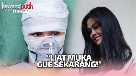 Eliza Tertawa Diatas Penderitan Anna Bawang Putih Berkulit Merah Antv