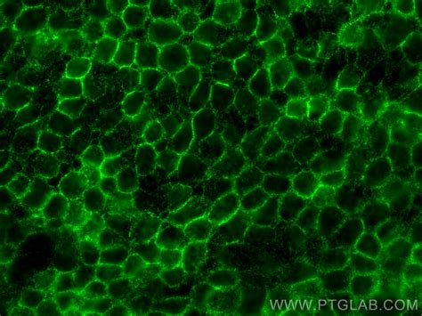 Beta 2 Microglobulin Antibody 13511 1 Ap Proteintech