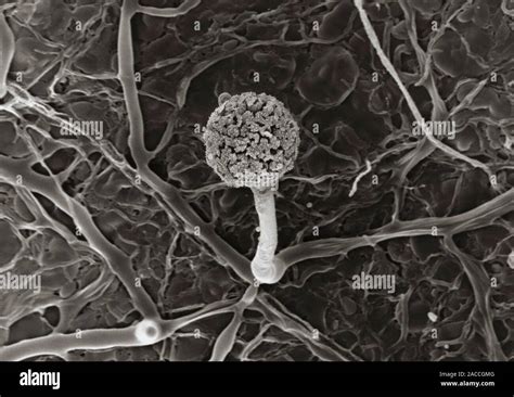 Scanning Electron Micrograph Of A Bread Mould Mucor Mucedo Growing On