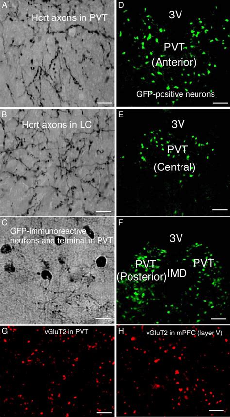 Glutamate Vesicular Transporter 2 Vglut2 Green Fluorescent Protein