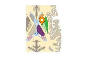 Medial segment of globus pallidus - e-Anatomy - IMAIOS